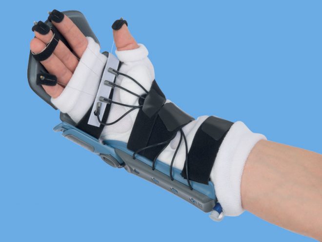 VACO®hand Flex – Obex