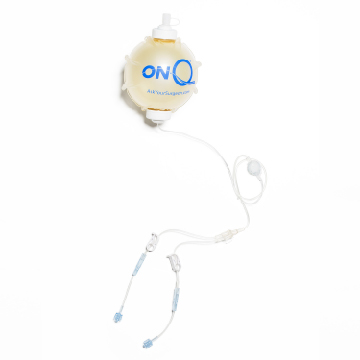 Surgical Specialities ON-Q® Pain Relief Pump System